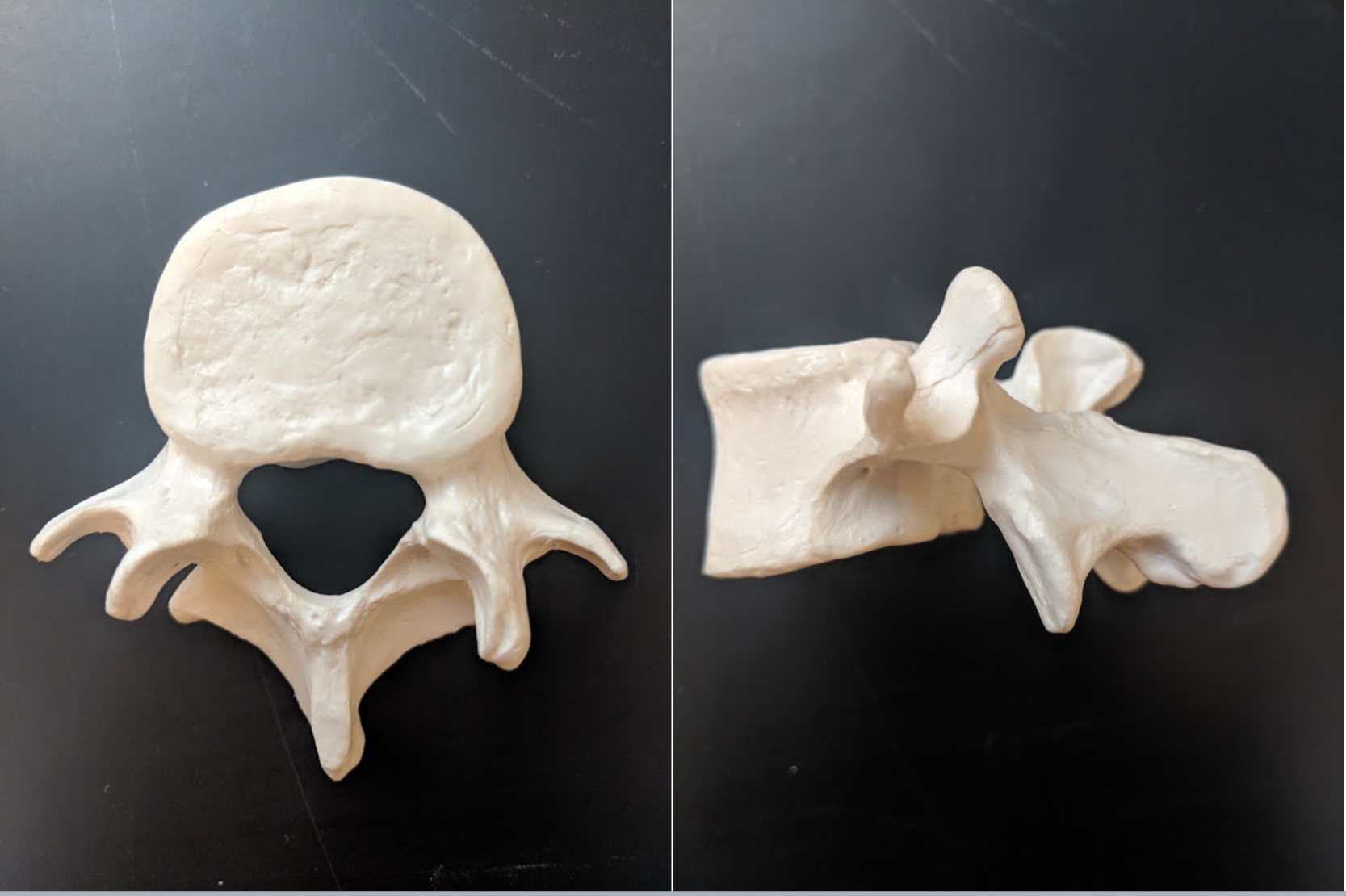 <p>Name this bone</p>