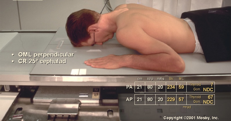 <p>What position is this?</p>