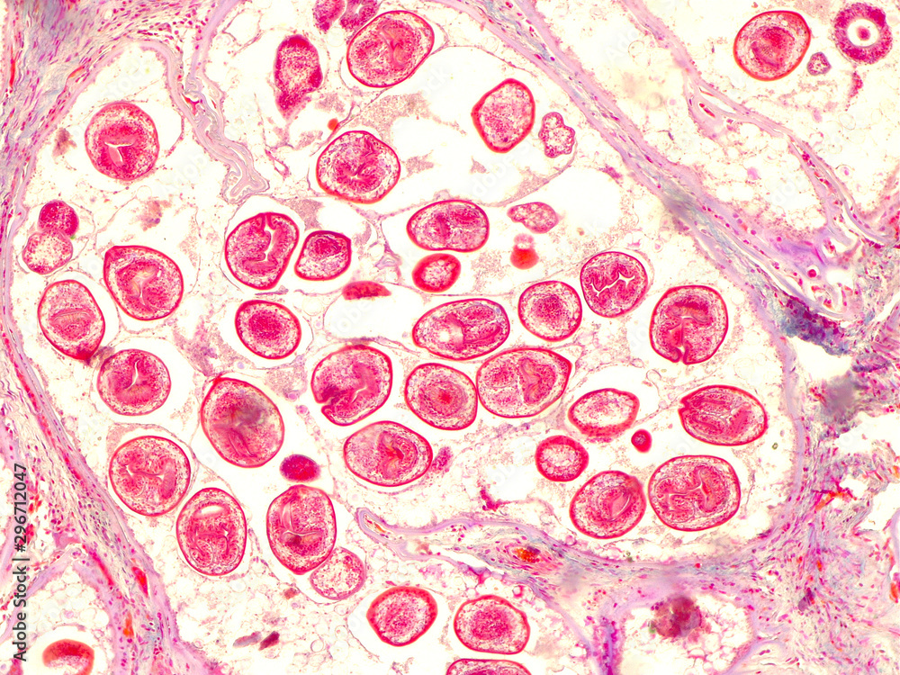 <ul><li><p>Hyatid Tapeworm</p></li><li><p>Damages bones and organs</p></li><li><p>Infects human by creating cysts in one of the organs</p></li></ul>