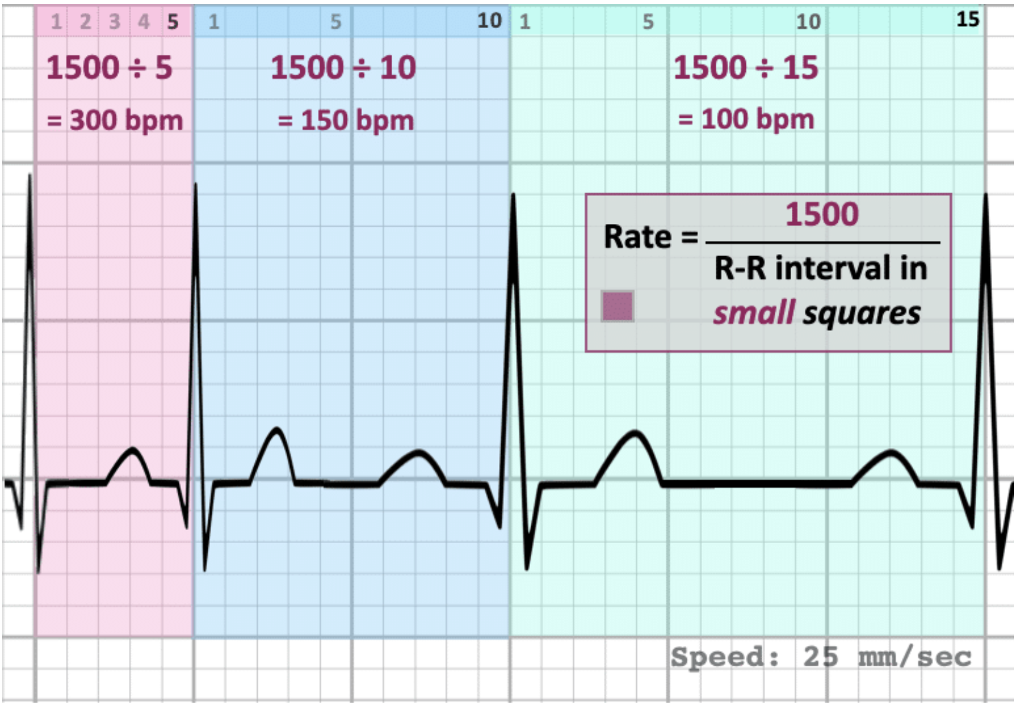 <ul><li><p><strong>6 second method</strong>: Count the number of R waves in a 6 second strip x 10 </p><ul><li><p>Used for regular or irregular rhythms </p></li></ul></li><li><p><strong>Small box method</strong>: HR = 1500/ # Small boxes </p></li></ul><p></p>