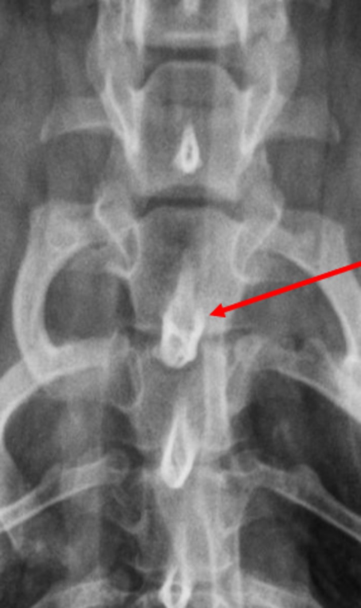 <p>The T1 dorsal spinous process will be superimposed with the caudal aspect of T1, while C7 will have a more central dorsal spinous process</p>