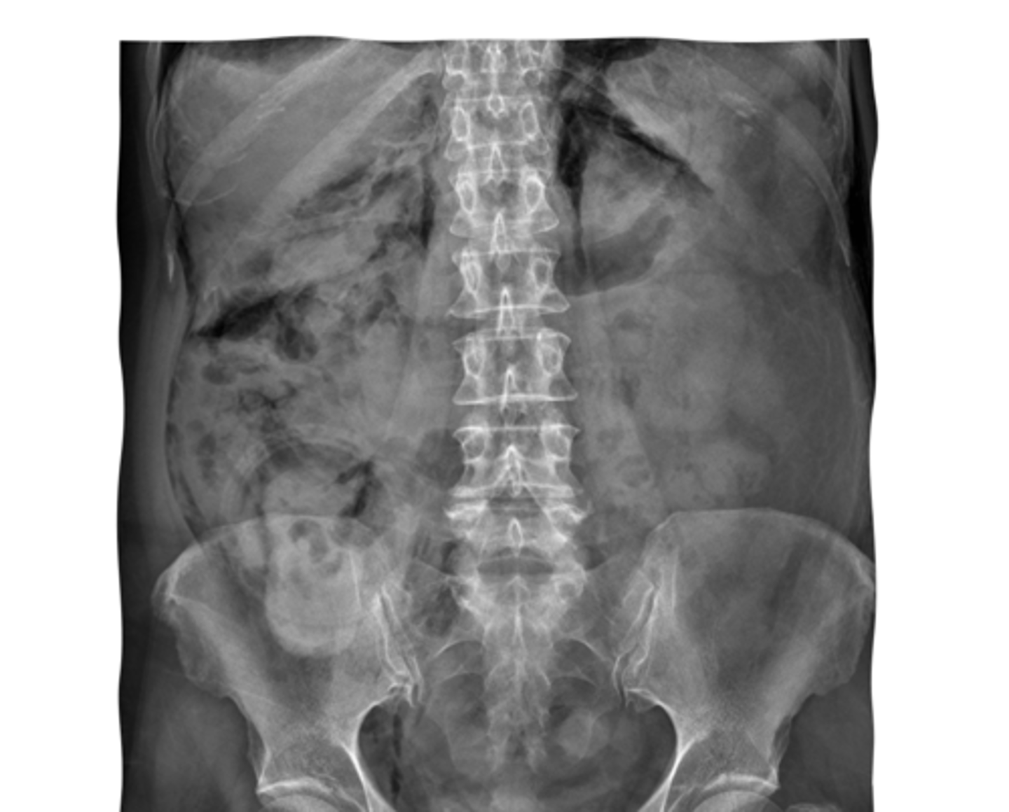 <p>identify what this is</p>