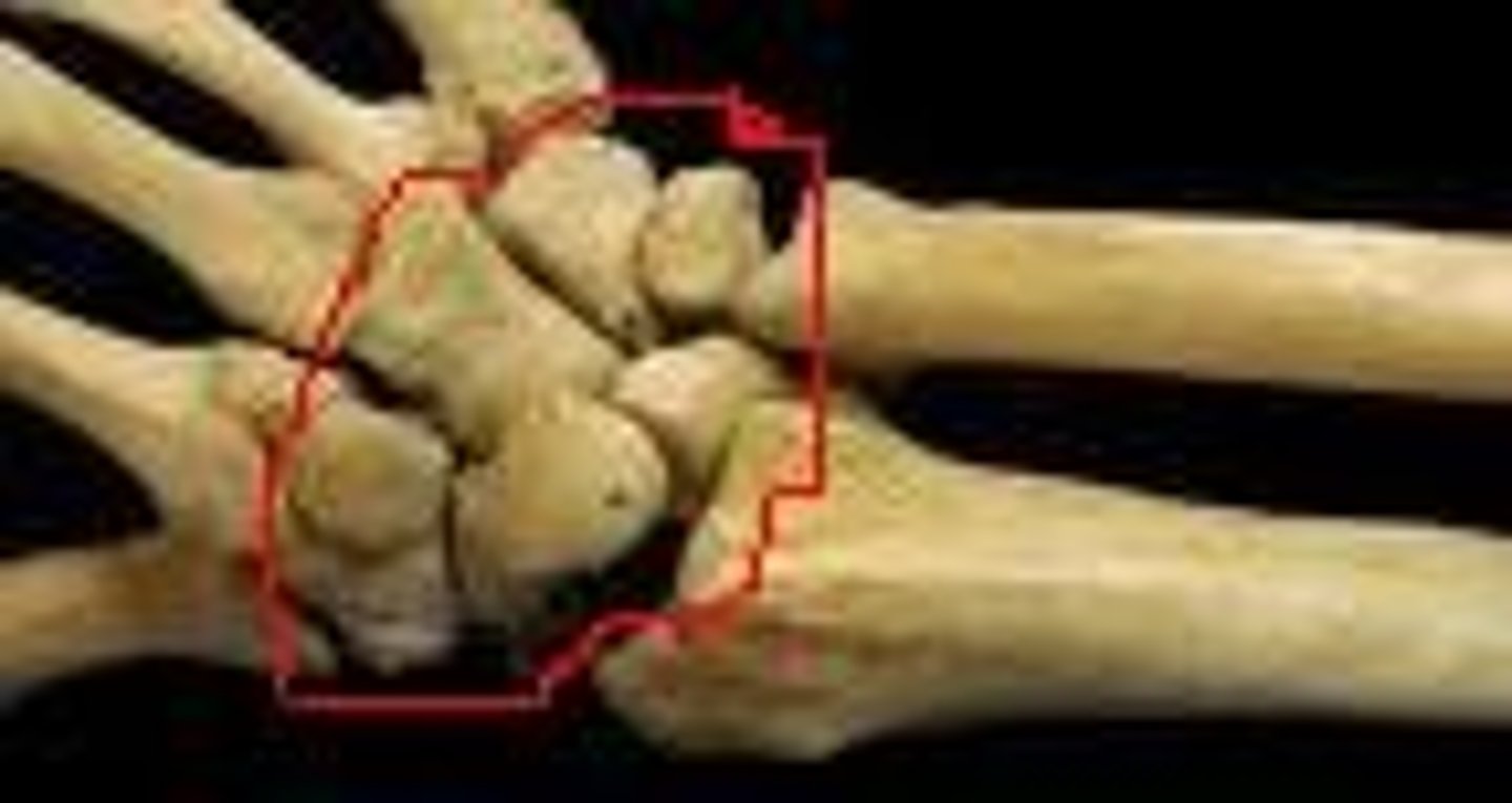 <p>the wrist bones</p>