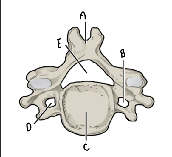 <p>Name and label the bone</p>