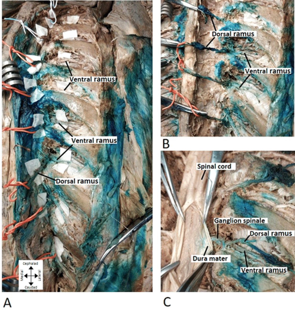 <p>anterior/main branch off spinal nerve</p>