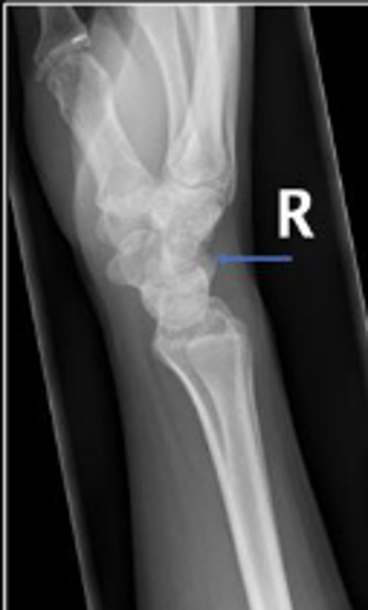 <p>What is outlined?</p>