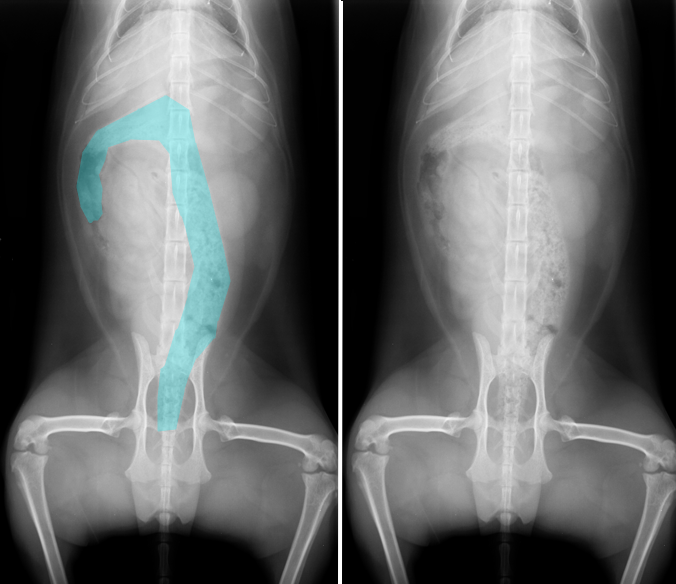 <p>What structure is highlighted in blue in the left image below?</p>