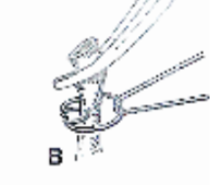 <p>What type of ligature does this image show?</p>