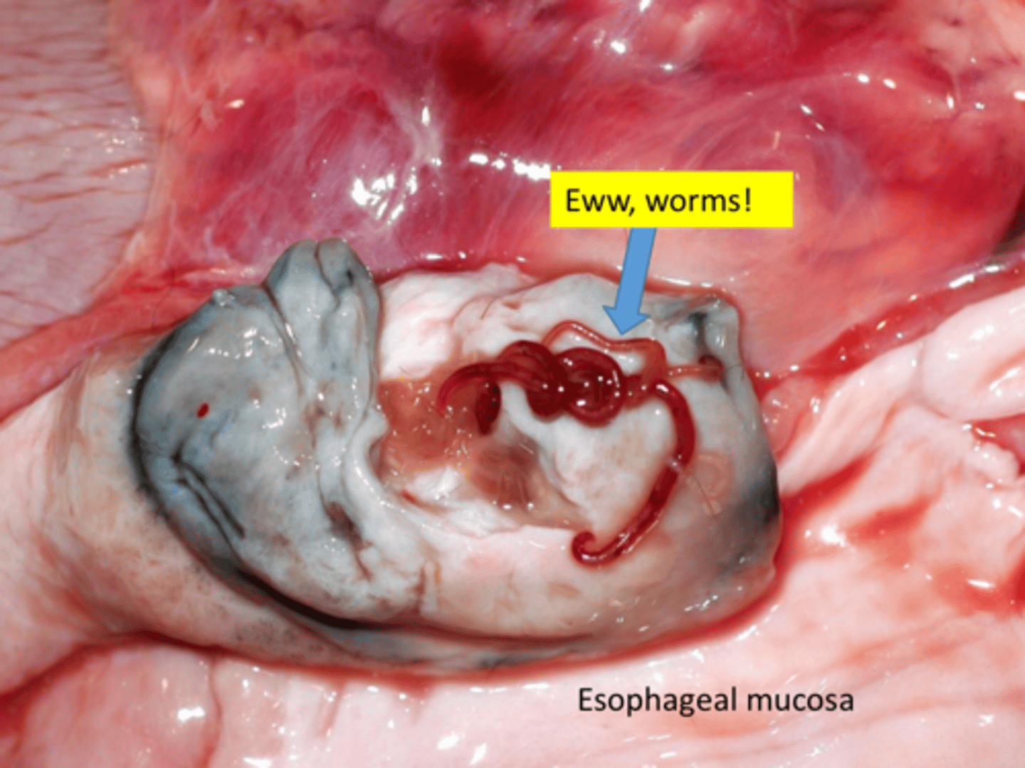 <p>Explain the pathogenesis of how Spirocerca lupi will cause esophagitis?</p>