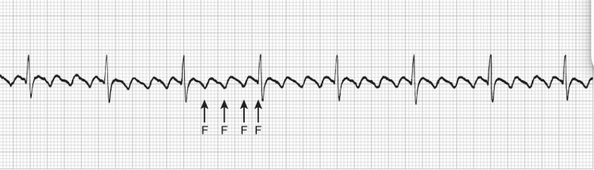 <p>what rhythm is this</p>