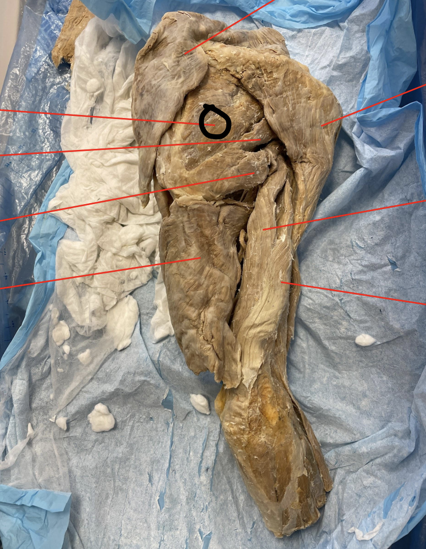 <p>identify + state origin, insertion, action, innervation of marked structure</p>