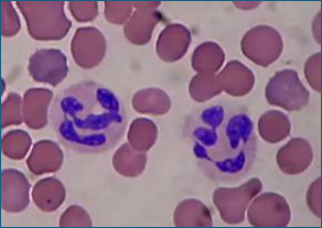 <p>Segmented purple nucleus and pink pale granules </p>