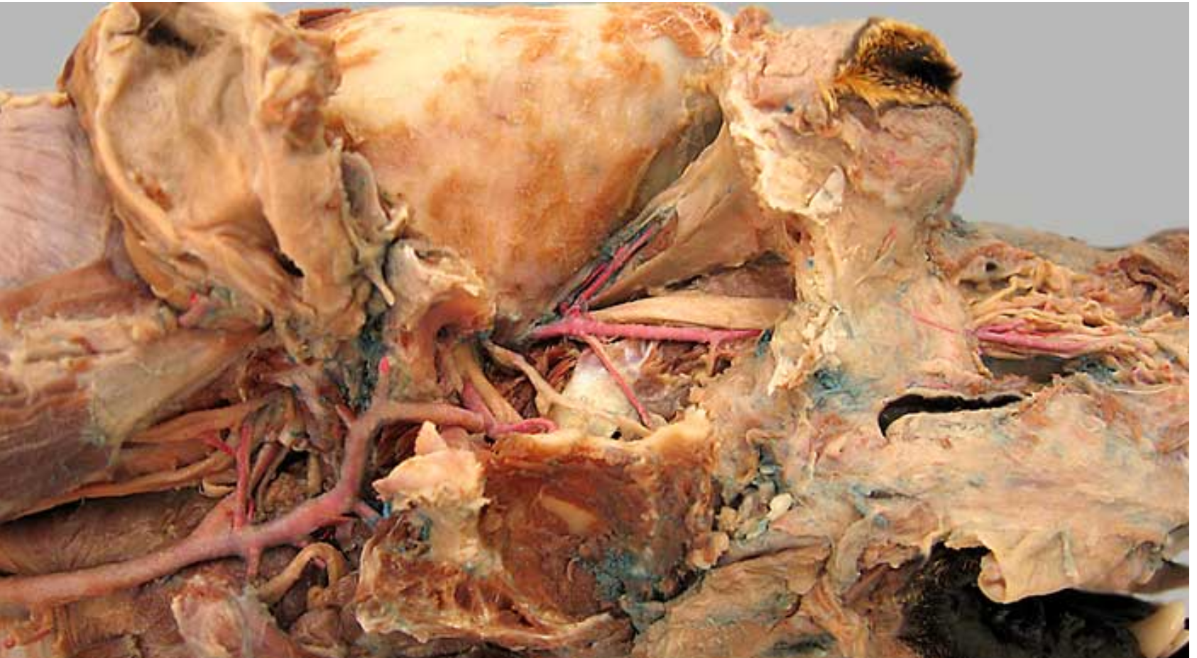 <ol><li><p>common carotid artery: in carotid sheath, splits into internal &amp; external</p></li><li><p>internal carotid artery: smaller branch</p></li><li><p>external carotid artery: larger branch</p></li><li><p>maxillary artery: larger terminal branch of ECA, supplies blood to head</p></li><li><p>-</p></li><li><p>-</p></li><li><p>occipital artery: branch of ECA, right next to ICA, supplies meninges &amp; skull</p></li><li><p>-</p></li><li><p>lingual artery: ventral branch of ECA, supplies tonsil &amp; tongue</p></li><li><p>facial artery: branches off ECA after ^, supplies nose &amp; lips</p></li><li><p>superficial temporal artery: small terminal branch of ECA, rostral to caudal auricular, supplies parotid gland &amp; temporal muscles &amp; eyelids</p></li></ol><p></p>