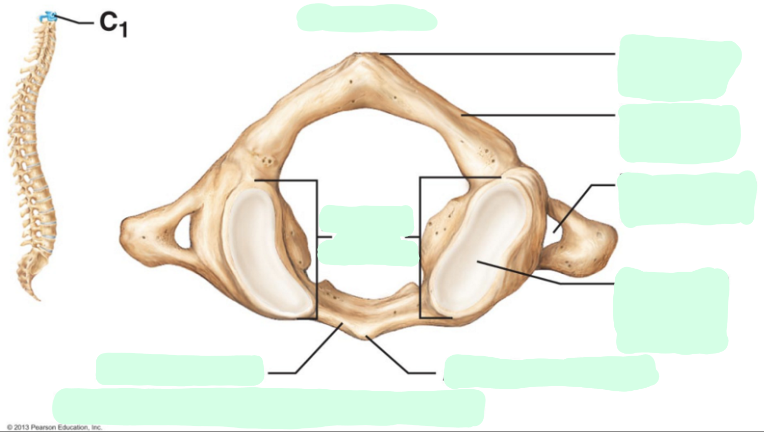 <ul><li><p>Superior view of atlas</p></li><li><p>One of the cervical vertebrae (C1)</p></li></ul><p></p>