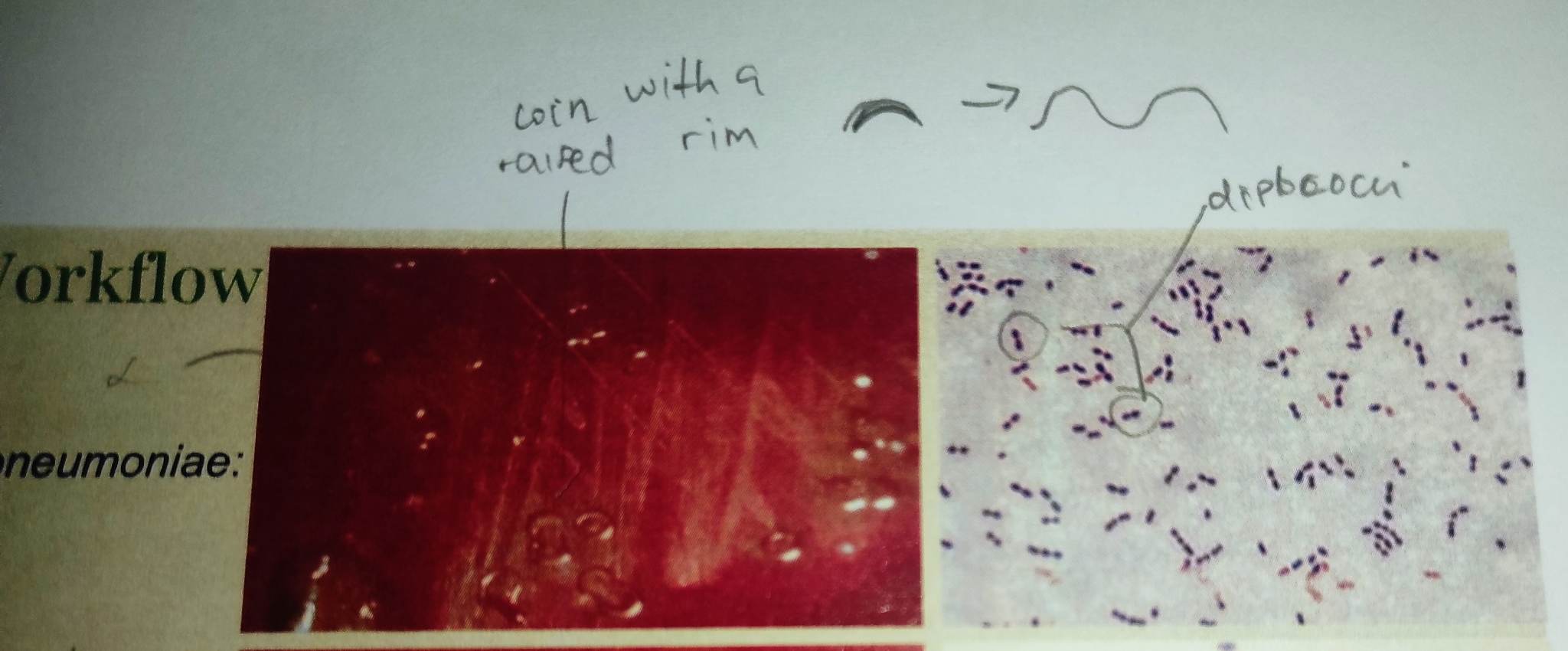 **Macroscopic examination** 

**Colonies:**

\
* round, glistening, wet, mucoid, dome-shaped/doughnut appearance with large zone of α-hemolysis on BAP surrounding the colonies