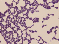 <p>what type of bacteria is this</p>