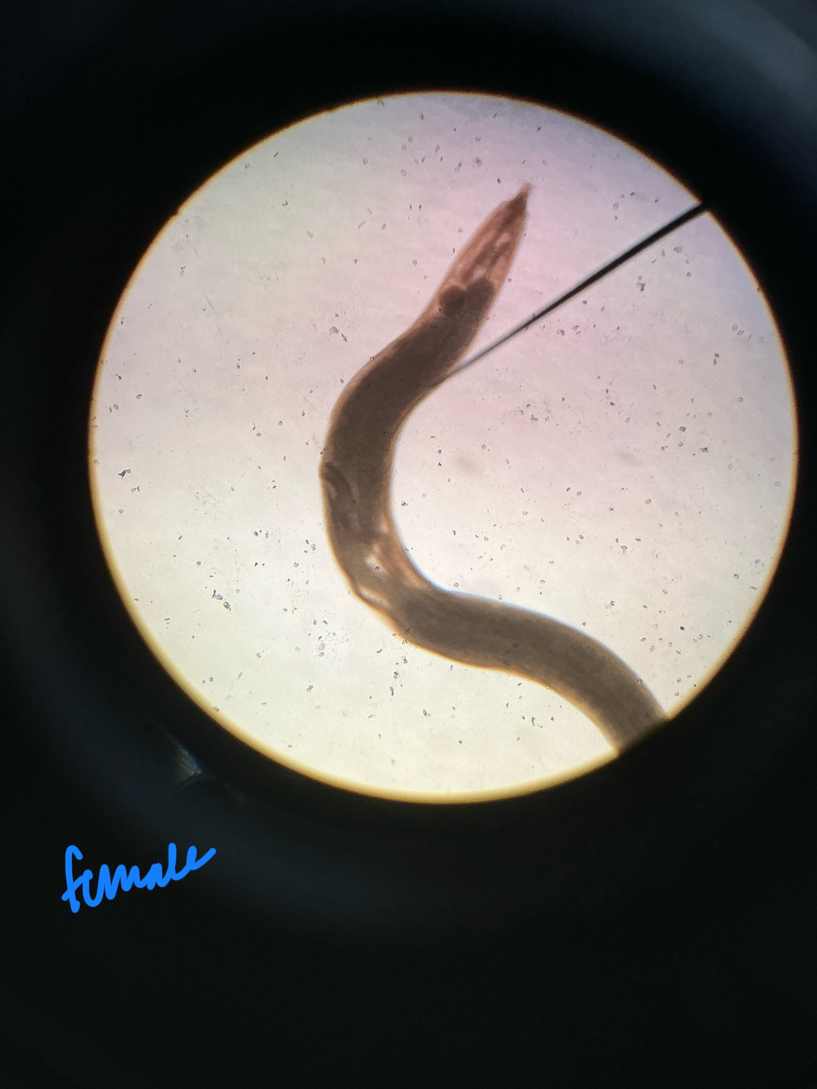 <p>Helminths</p>