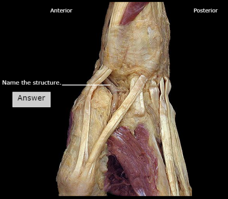 <p>What artery is this</p>
