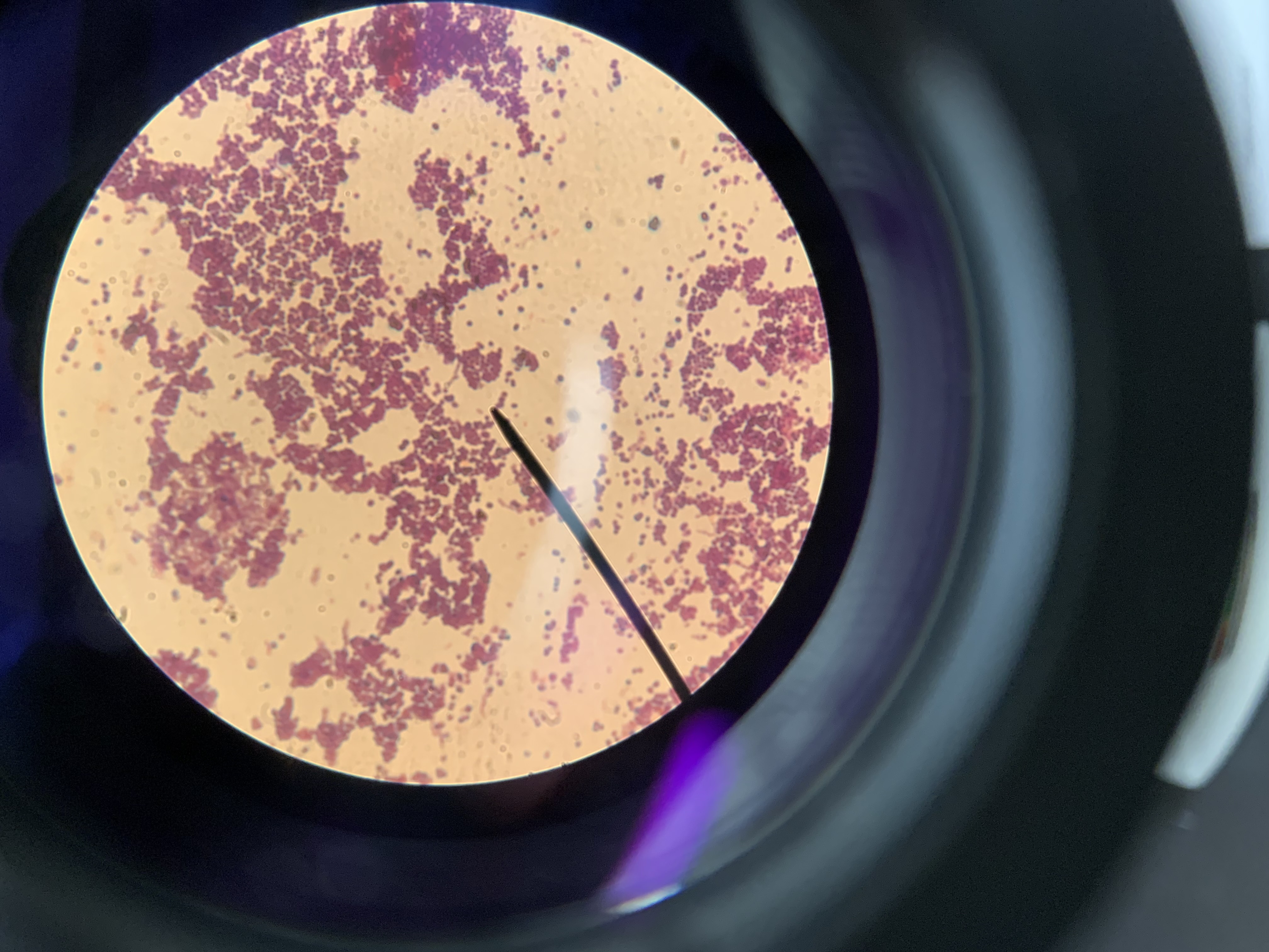 <p>is this a gram positive or negative bacteria</p>