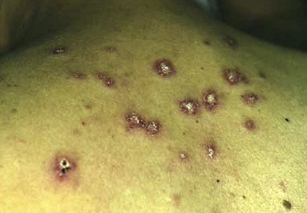 <p>What condition is this</p>