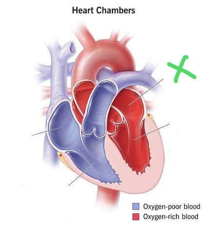 <p>Upper left chamber; receives oxygenated blood from pulmonary veins.</p>