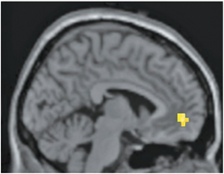 <p><span>The activated region in the fMRI scan above is responsible for which function?&nbsp;</span></p>