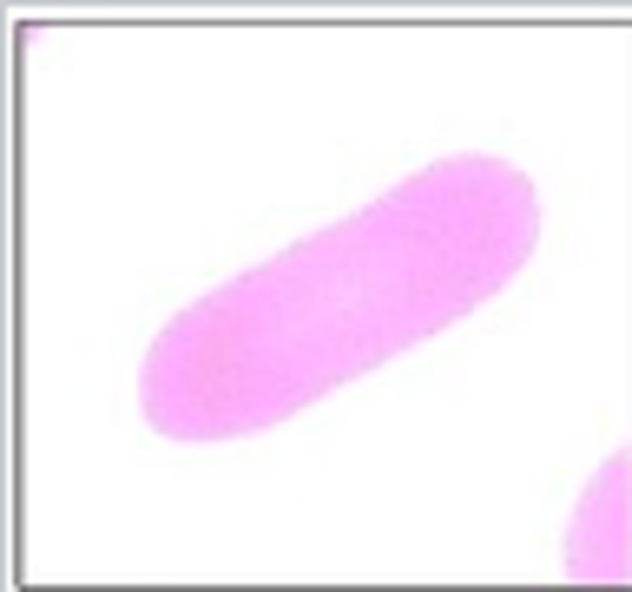 <p>What RBC morphology is this?</p>