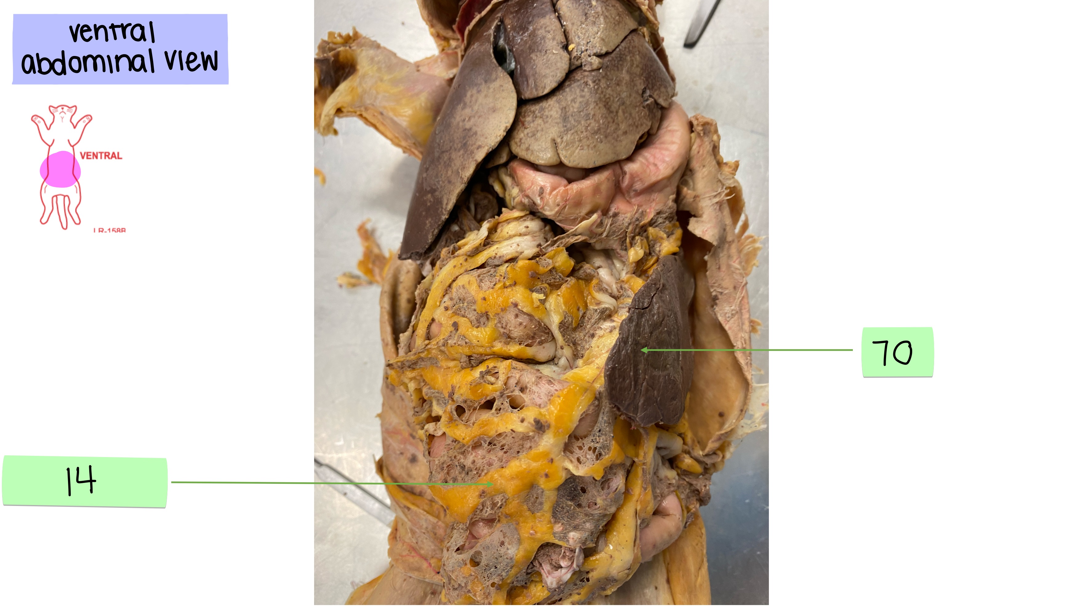 <p>greater omentum</p>