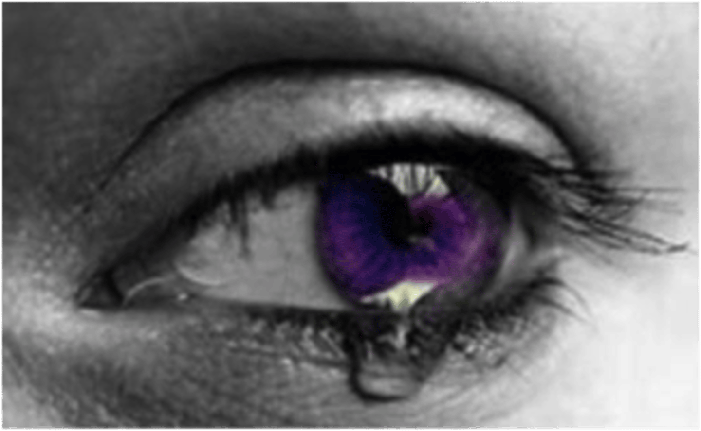 <p>affliction</p>