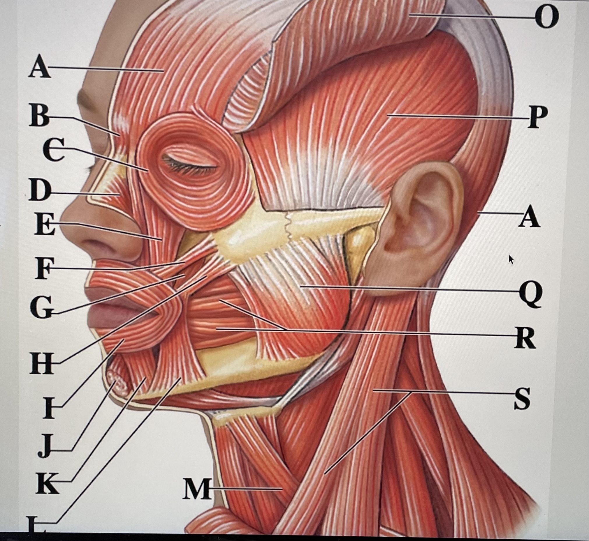 In the figure above,  *is the Sternocleidomastoid and letter* _ is the occipital belly of the epicranius 