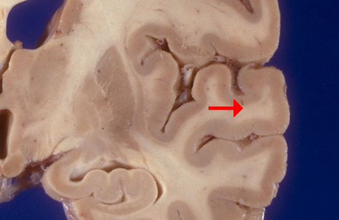 <p>Label this brain structure</p>
