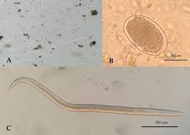 <p>The egg shown below is the diagnostic stage of an intestinal parasite. What is the infective stage of this helminth?<br><br></p><p>egg as shown here</p><p>A fully embryonated egg</p><p>A filariform larva</p><p>A rhabditiform larva</p><p>None of the above</p>
