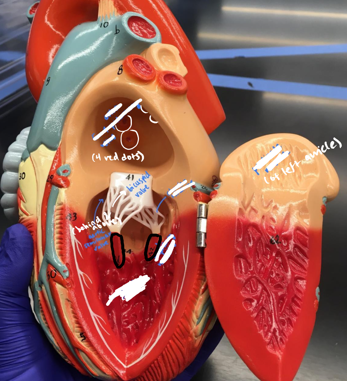<p>The red connections from the trabeculae carnae and the chordae tendinae under the bicuspid valve</p>