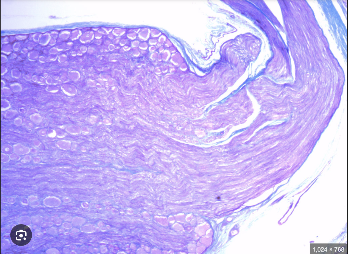 <p>what are the structural neurons of this?</p>