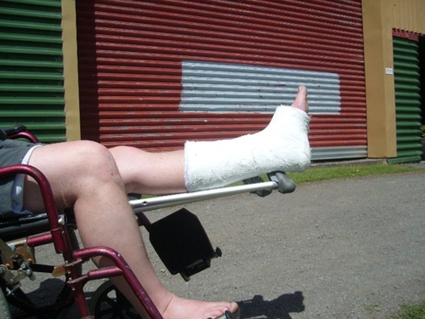 <p>Bó bột - vật cứng bảo vệ xương gãy. (He has a cast on his leg - Anh ấy bị bó bột ở chân.)</p>