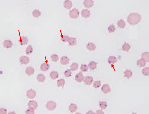 <ul><li><p>CBC → regenerative anemia suggestive</p></li><li><p>cytologic exam of blood smear → organisms within RBCs</p><ul><li><p><strong>dense</strong> cocci at RBC <strong>margins</strong></p></li></ul></li><li><p><strong>PCR</strong></p></li><li><p>serology</p></li></ul><p></p>