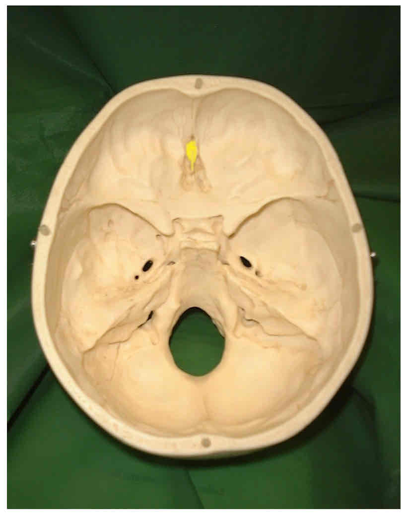 term image
