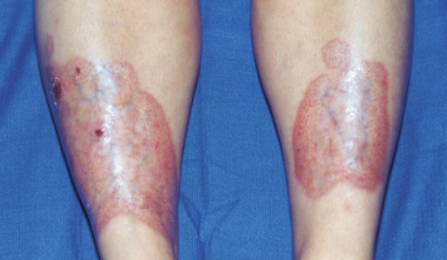 <p>What is the diagnosis?</p>