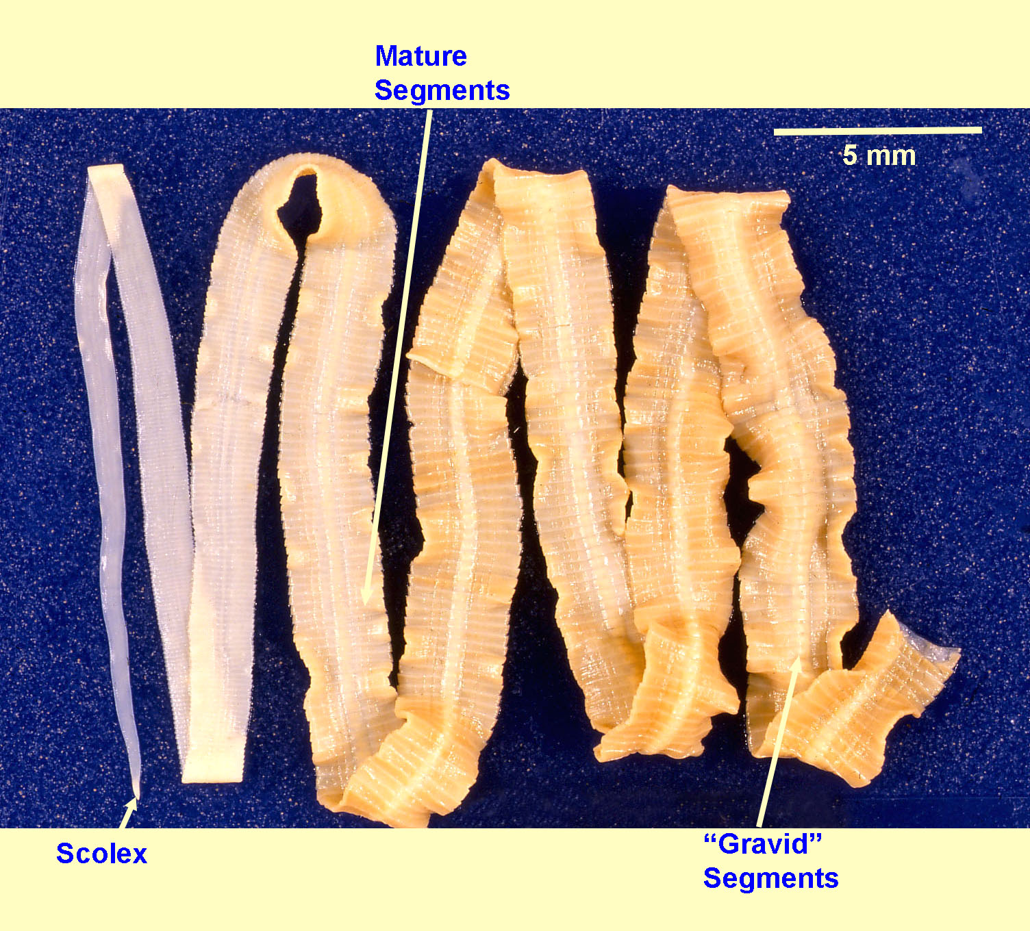 <p>in human</p><p>anemia, intestinal obstruction, bile duct inflammation, or asymptomatic</p><p>history of eating raw fish</p><p>worldwide (endemic in Scandanavia, Baltic area, Russia, America)</p>