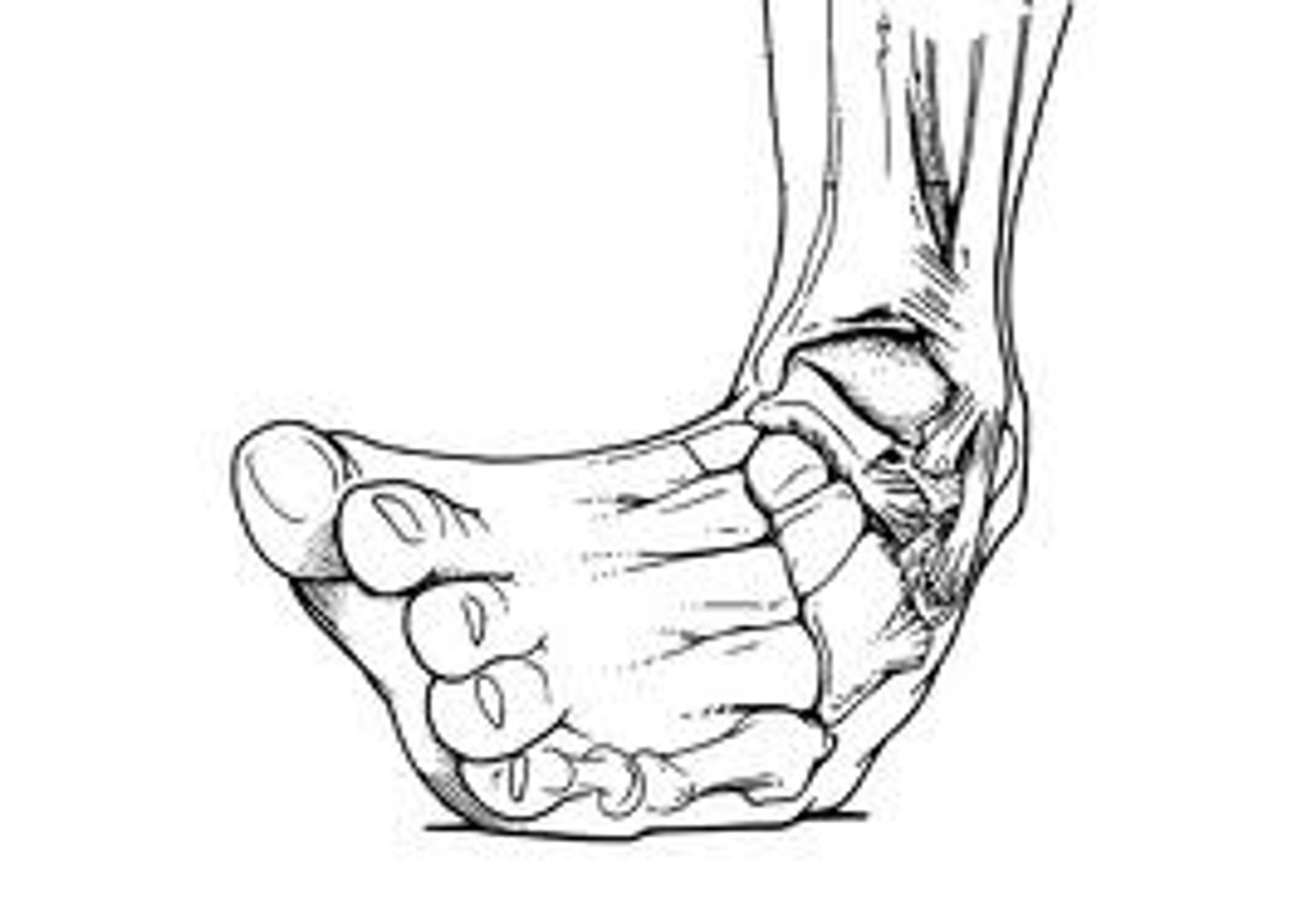 <p>to sprain/twist one's ___</p>