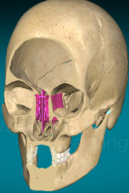 <p>What bone of the cranium is this?</p>