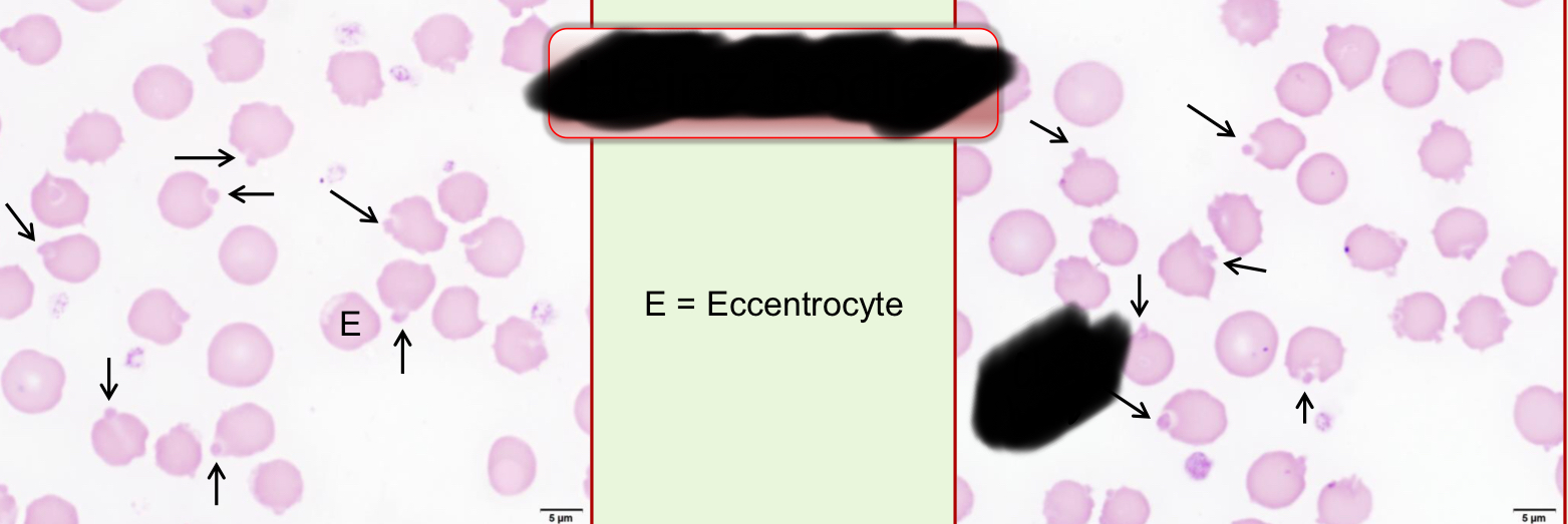 <p>What RBC inclusion is depicted in this image?</p>