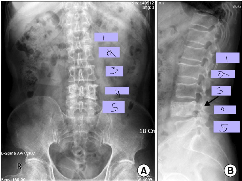 <p>#2</p>