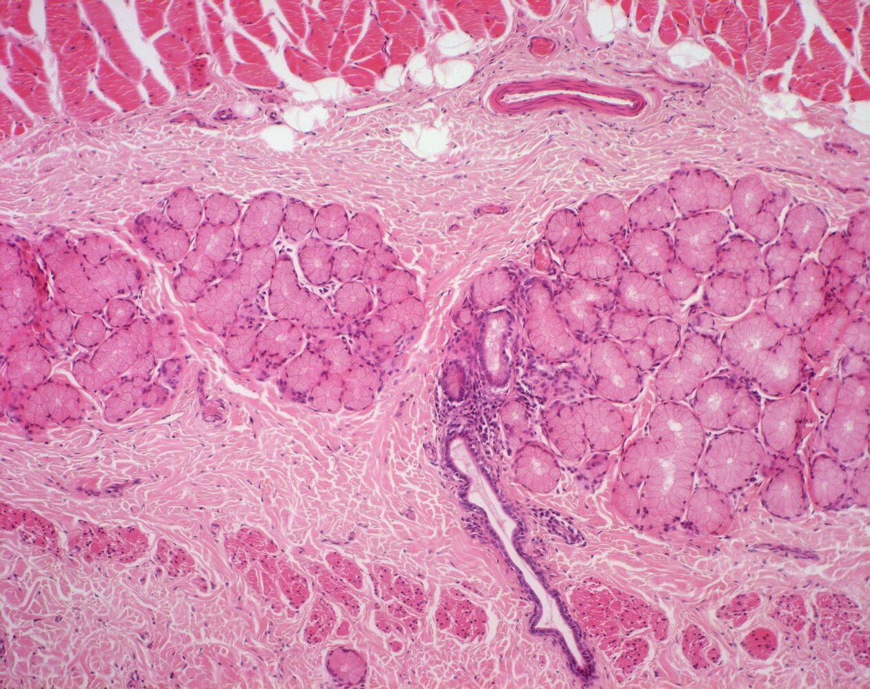 <p>C. Mucous glands</p>