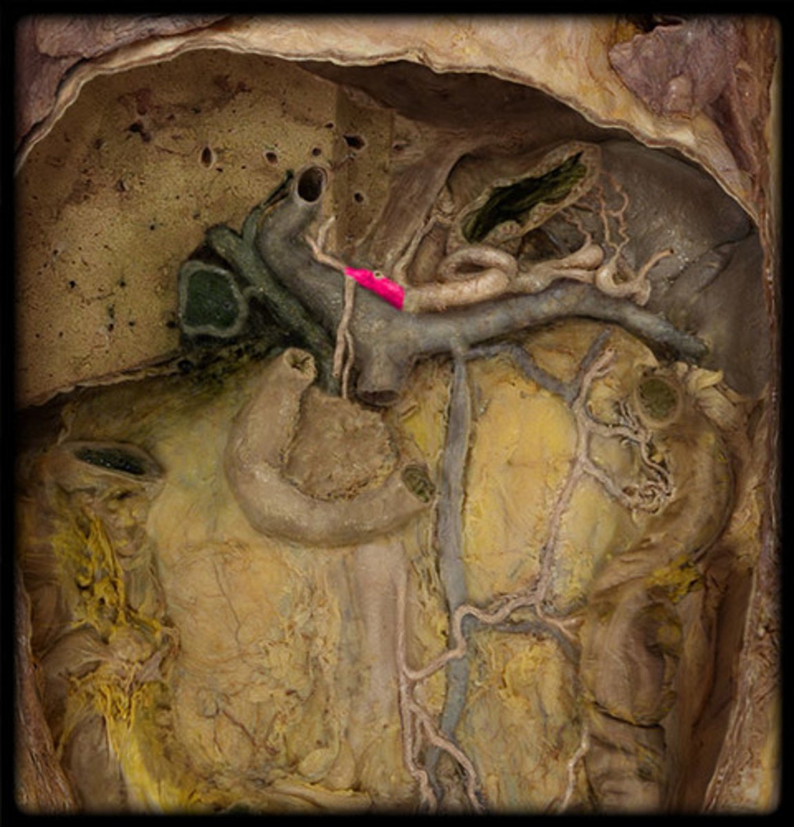 <p>Supplies the liver</p>