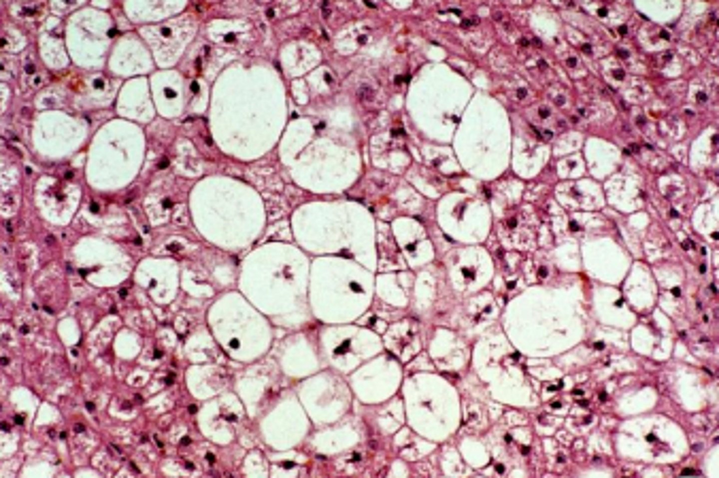 <p>glycogen</p><p>central nuclei, some webbing</p>