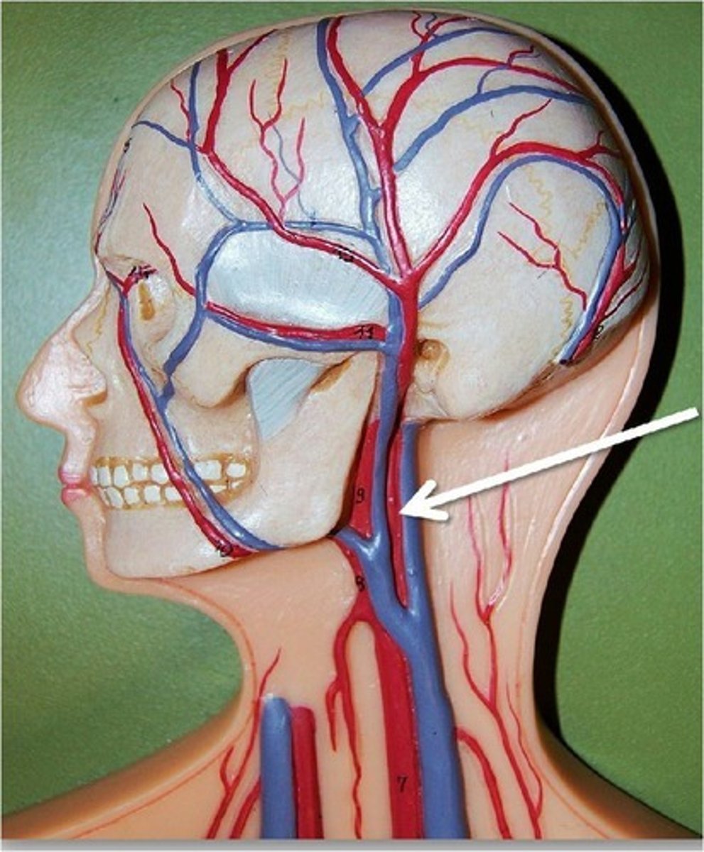 <p>Name the blood vessel.</p>