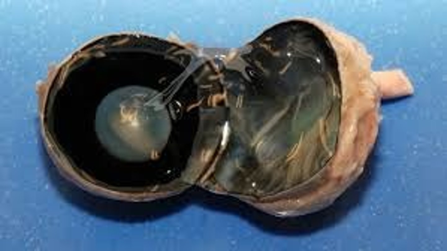 <p>what is the fluid between the retina and the lens?</p>
