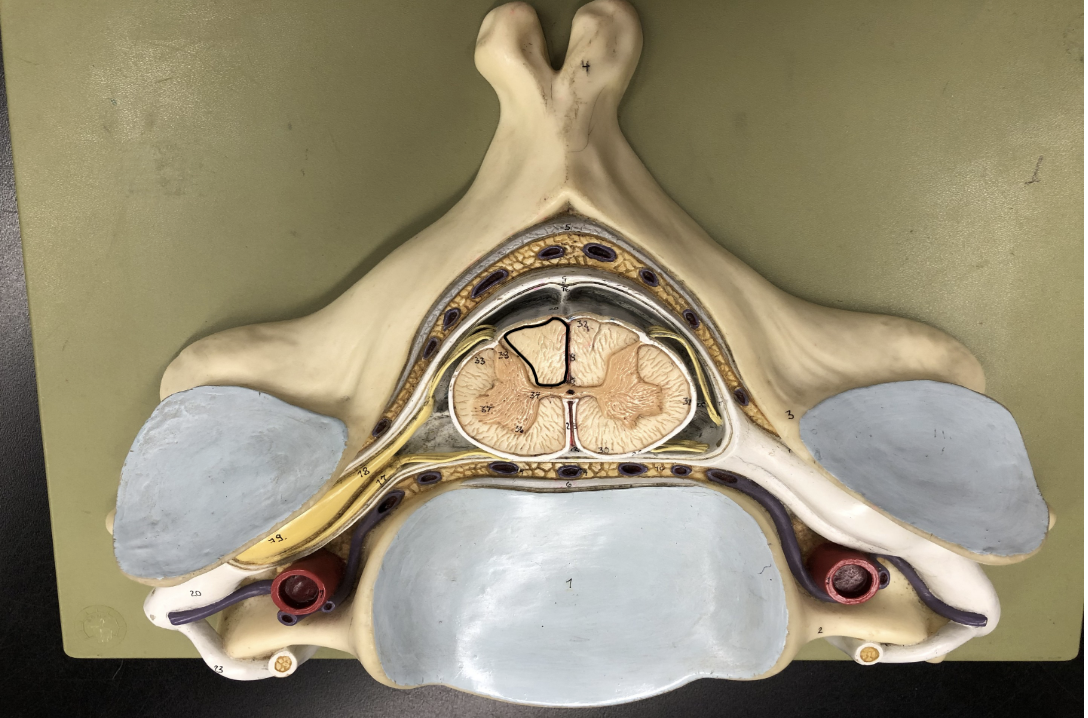 <p>what is this part of the vertebrae (of the spinal cord?)</p>
