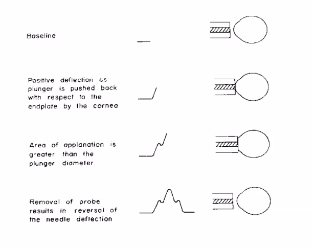 <p>how does mackray marg work?</p>